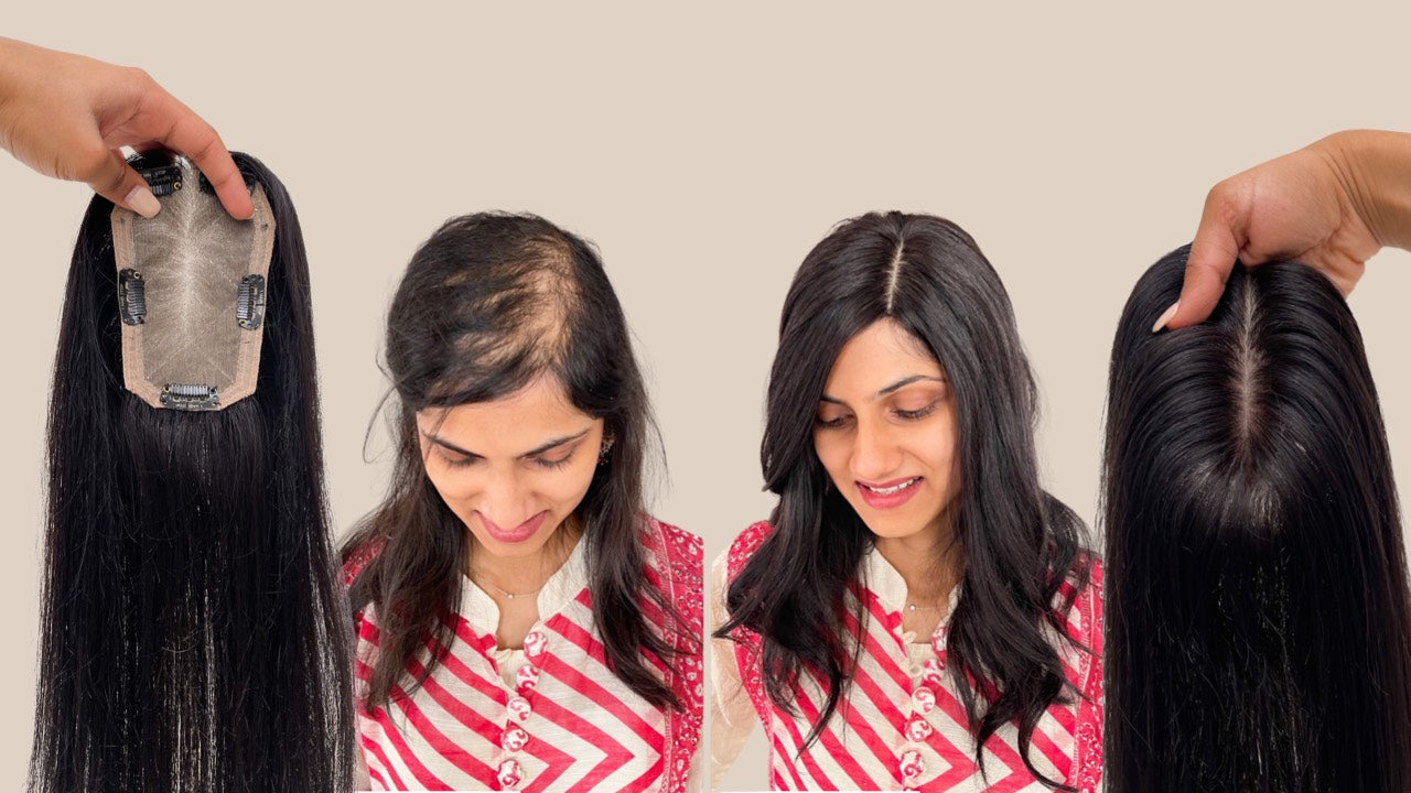 How Hair Toppers Can Top Up Your Confidence