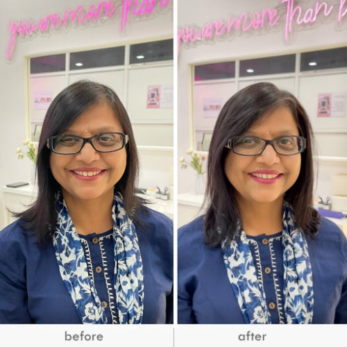 Front Hair Extensions Invisible CoverUp patch 1 Hair Stop India